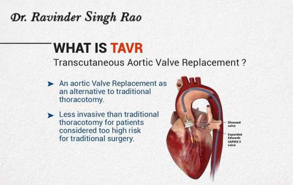 Finding the best heart specialist near you in Jaipur - Dr. Ravinder Singh Rao