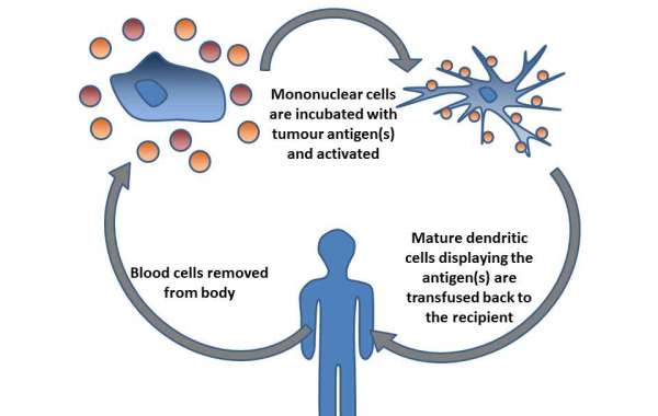 Harnessing Dendritic Cell Therapy: A Paradigm Shift in Non-Cancer Treatment Strategies