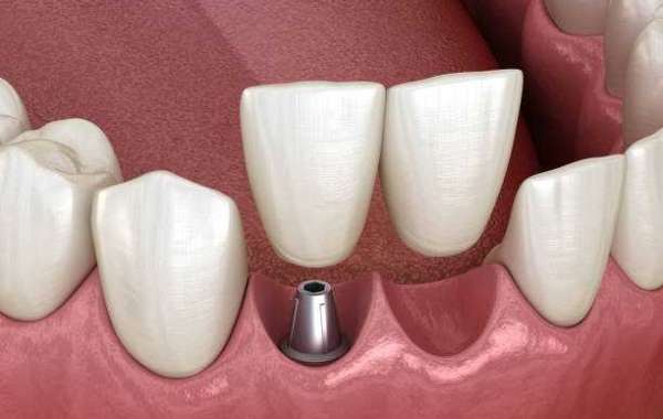 Tooth Regeneration is Estimated to Witness High Growth Owing to Expanding Geriatric Population
