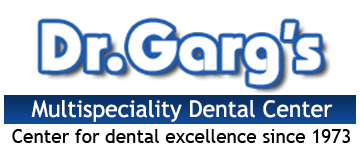 Teeth Implant – Procedure, Types and Cost Associated - Best Dental Clinic in Delhi near me | Best Dentist in New Delhi