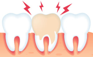 Emergency Dentist San Diego - Brite Smile Dental