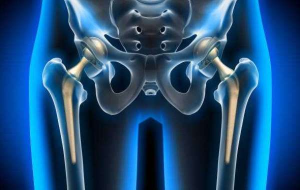 Hip Replacement Market is projected to Witness High Growth Owing to Growing Geriatric Population