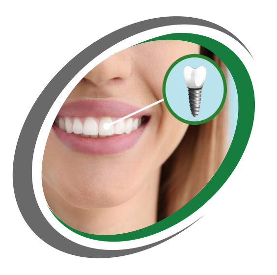 Affordable Dental Implants in Toledo Ohio - Point Place Dentist Care