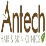 Antech Hair and Skin Clinics Profile Picture