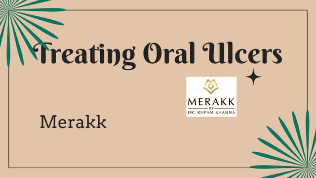 Engage with best oral care products for oral ulcers | PPT