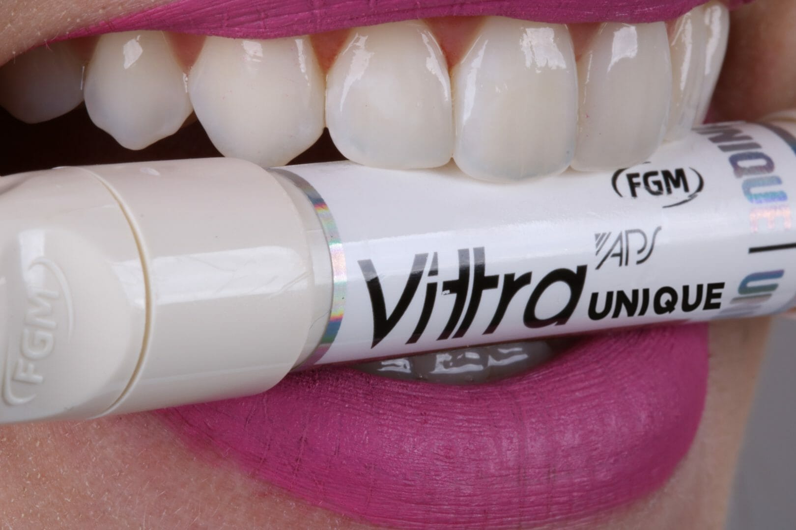 Replacement of composite in anterior tooth with Vittra APS Unique composite - FGMUS