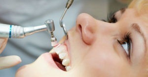 What are the Benefits of Cosmetic Dentist Services? | TheAmberPost