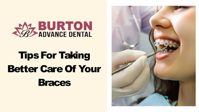 Tips For Taking Better Care Of Your Braces | PPT