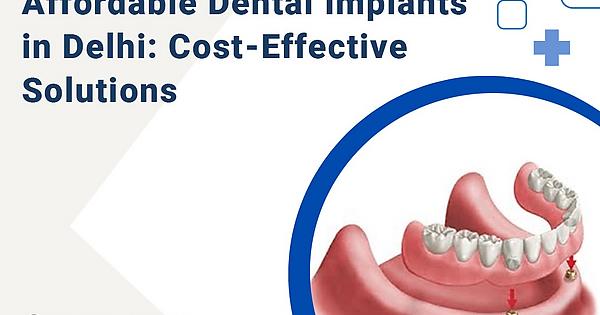 Affordable Dental Implants in Delhi: Cost-Effective Solutions