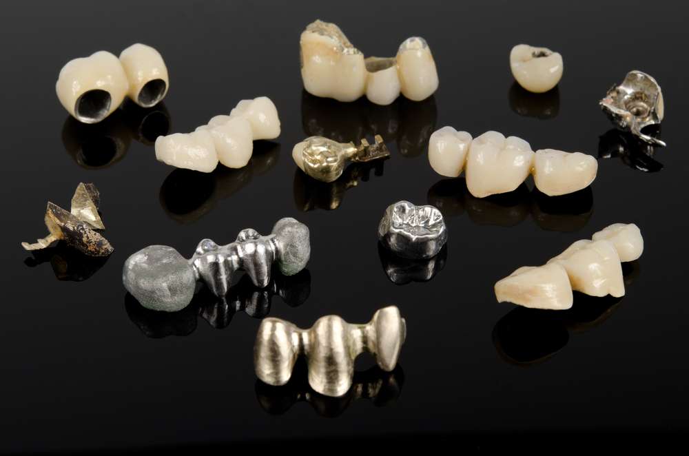 Get Quality Dental Crowns at the Best Clinic in Delhi