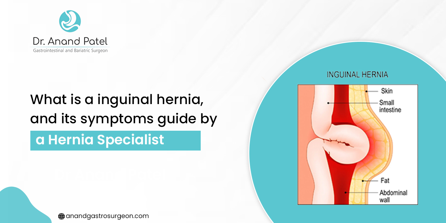 Inguinal Hernia Symptoms & Diagnosis Guide by Hernia Specialist