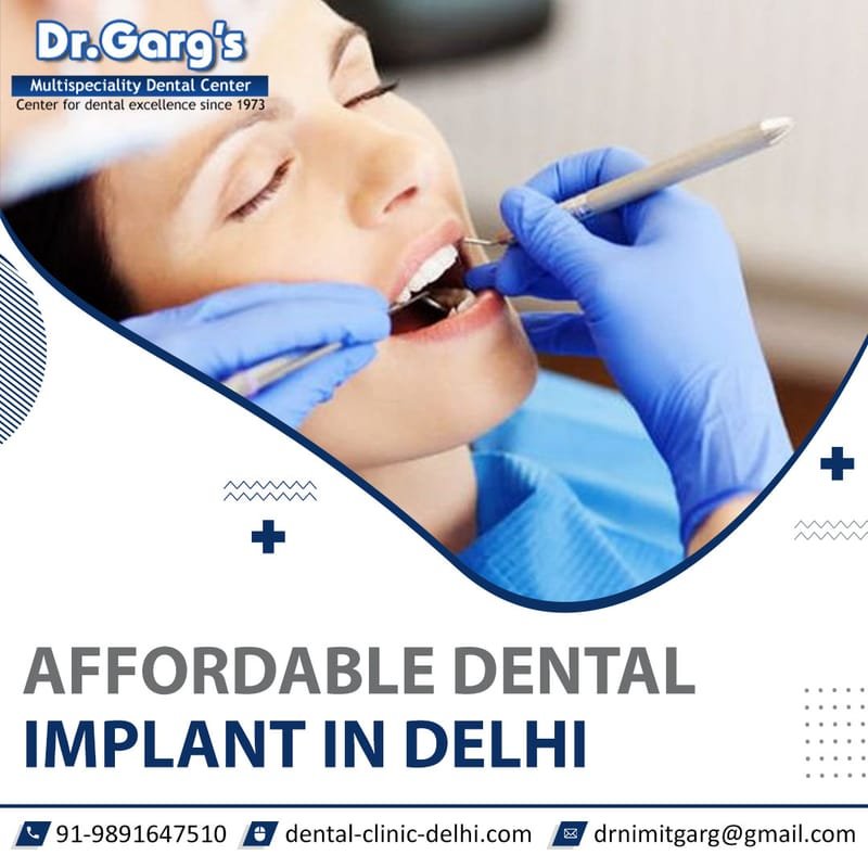 Get Top Dental Clinic in Delhi: Your Way to Exceptional Dental Care