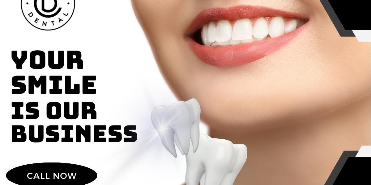 Dentist in Ventura | Why Dental Veneers Are Worth It