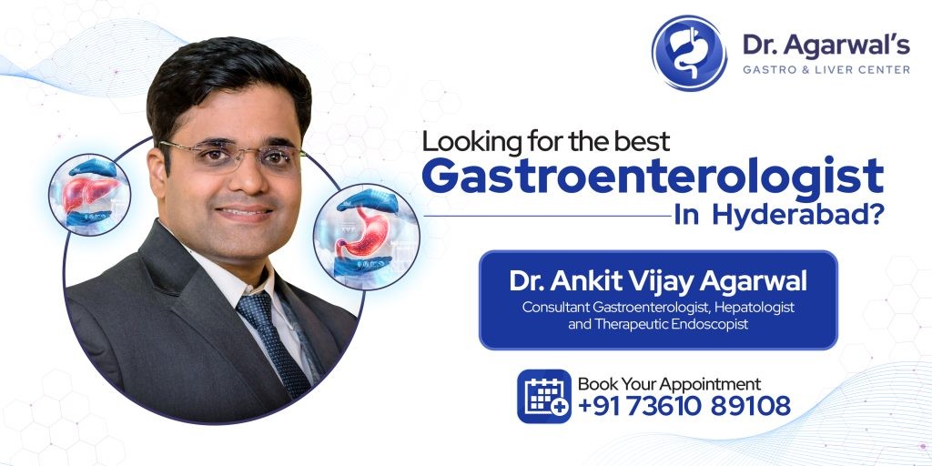 Inflammatory Bowel Disease Treatment In Hyderabad IBD doctor in Hyderabad Profile Picture