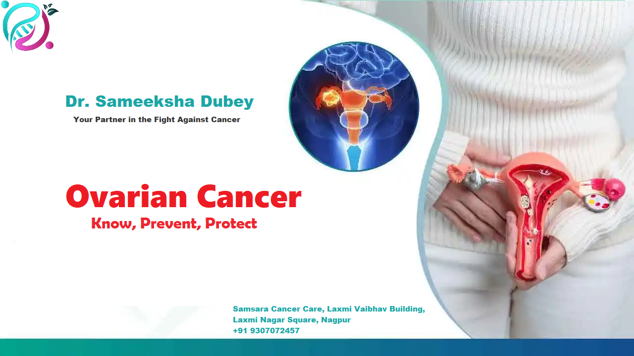 Ovarian cancer treatment in Nagpur - Best Oncologist in Nagpur