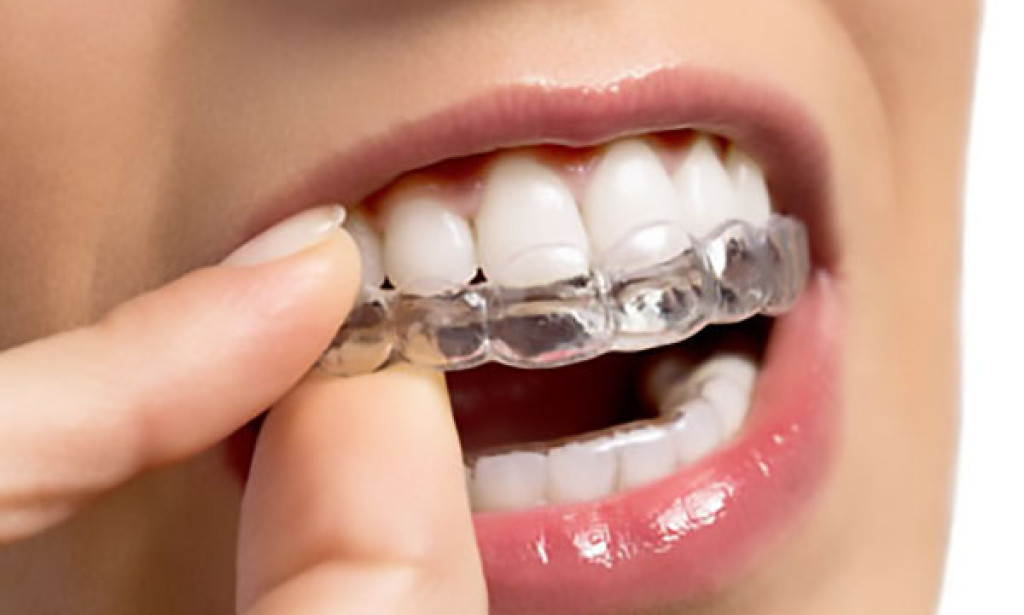 How to Deal with Discomfort During Invisalign Treatment?