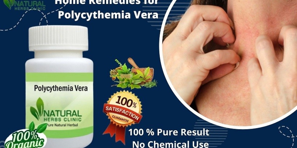 Top 5 Innovative Treatments for Polycythemia Vera You Can’t Ignore