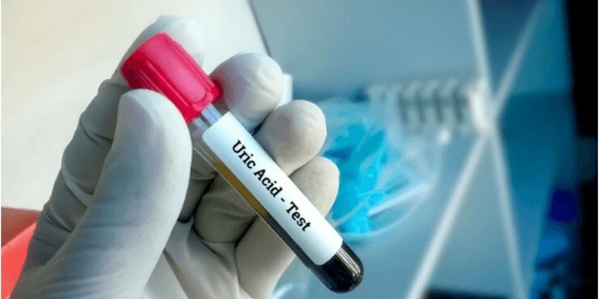 Why Your Doctor May Recommend a Uric Acid Blood Test