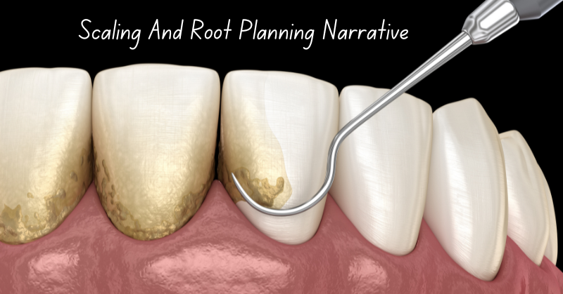 Scaling and Root Planning Narrative: Best Guide | 2024