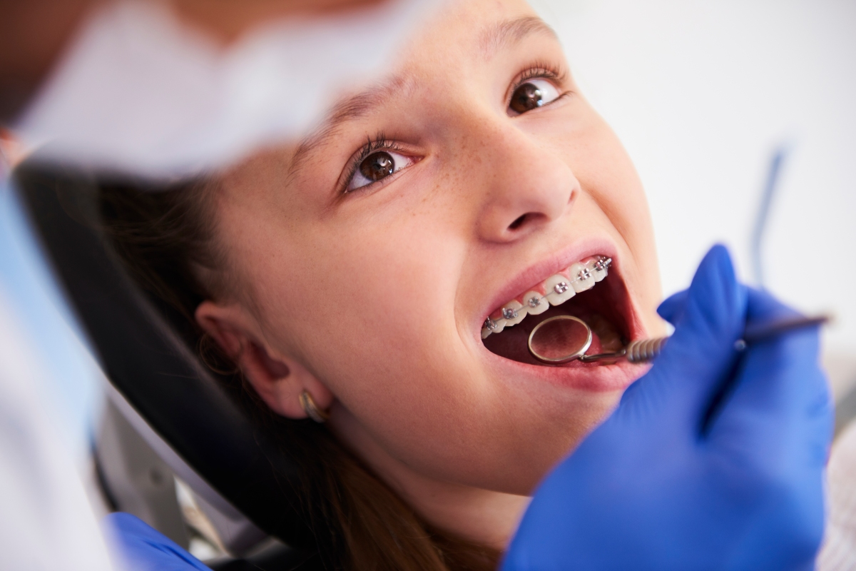 Why Do I Need Braces? Common Reasons for Orthodontic Treatment – Vista Dental