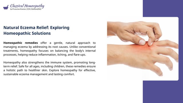 Natural Eczema Relief: Exploring Homeopathic Solutions | PPT | Free Download