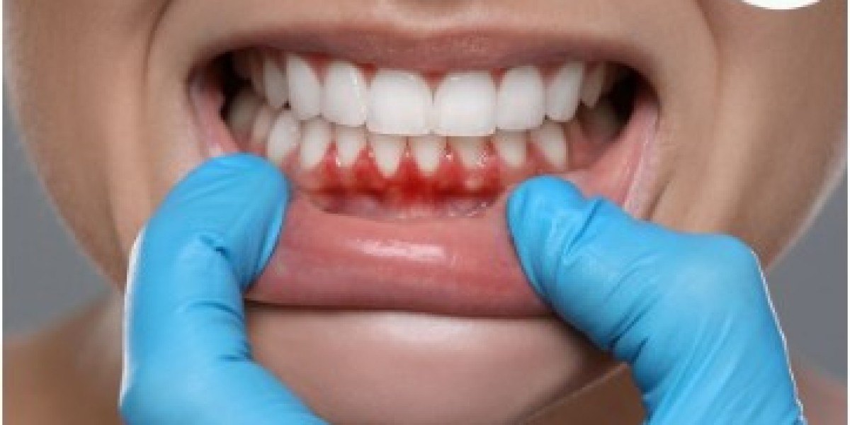 Expert Dental and Maxillofacial Services at Dental Park, Ghaziabad