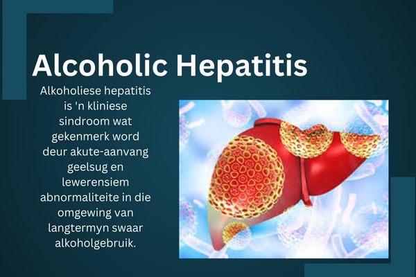 (Alcoholic Hepatitis)Alkoholiese hepatitis