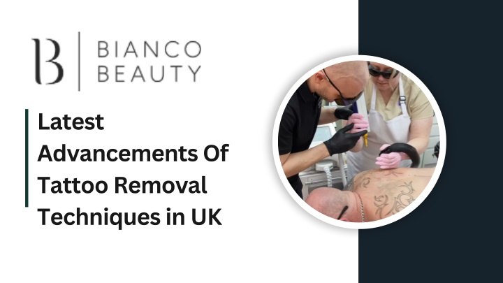 Latest Advancements Of Tattoo Removal Techniques in UK