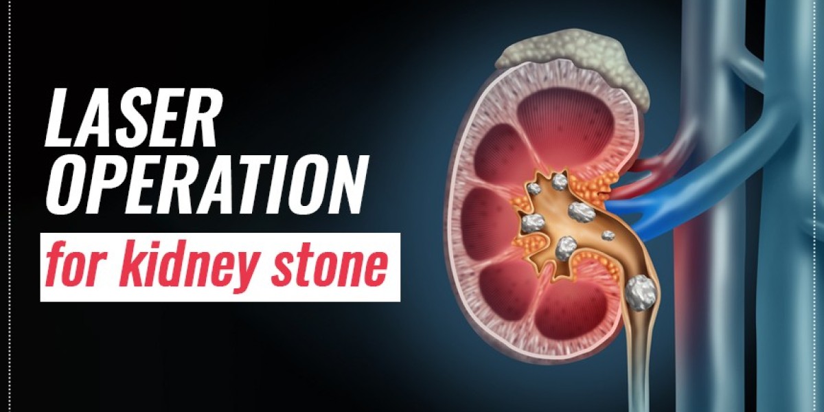 Laser Operation For Kidney Stone | World of Urology