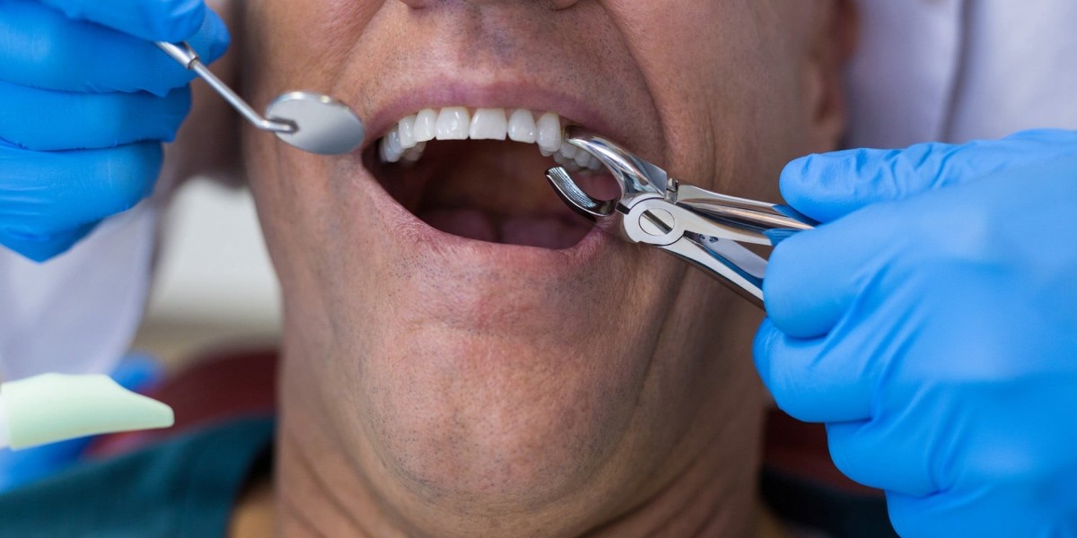 Tooth Extraction in Las Vegas: What You Need to Know