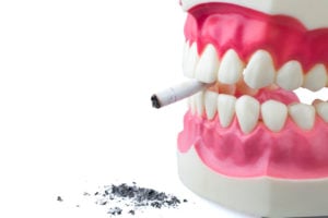 Most Common Causes of Oral Cancer – Perdido Bay Dental