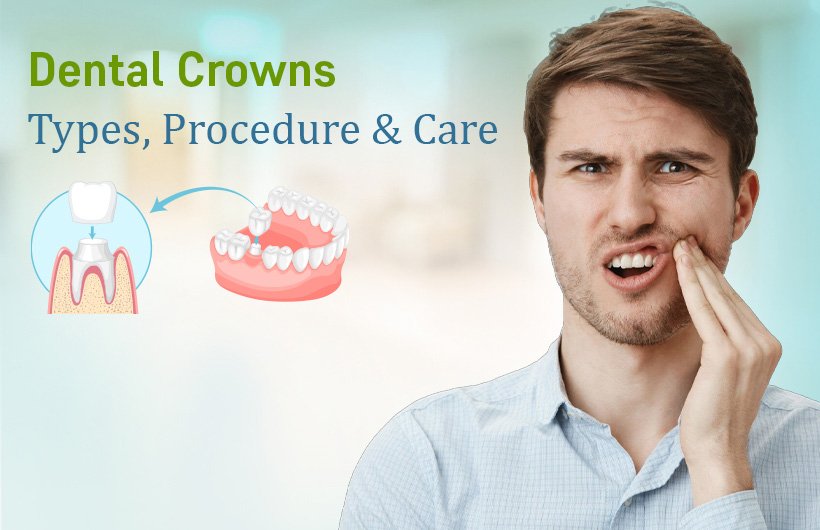 Dental Crowns: Types, Procedure & Care - Sweet Tooth Dental Clinic