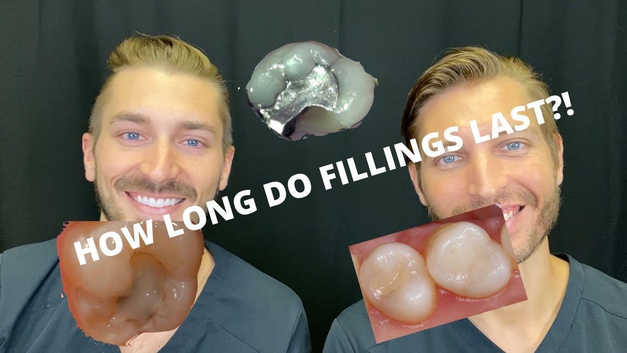 How Long Do Fillings Take - Daily Blog Zone