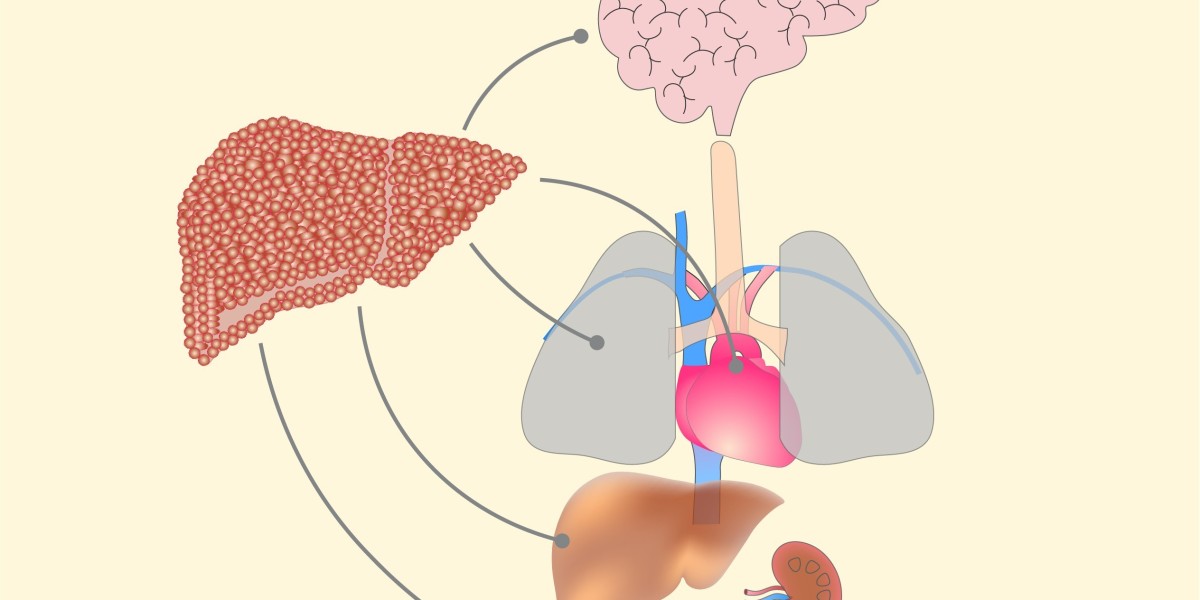 Acute on Chronic Liver Failure (ACLF) Market is Anticipated to Witness High Growth Owing to Rising Prevalence of Liver D