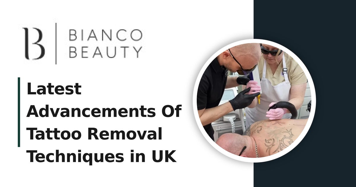 Latest Advancements Of Tattoo Removal Techniques in UK