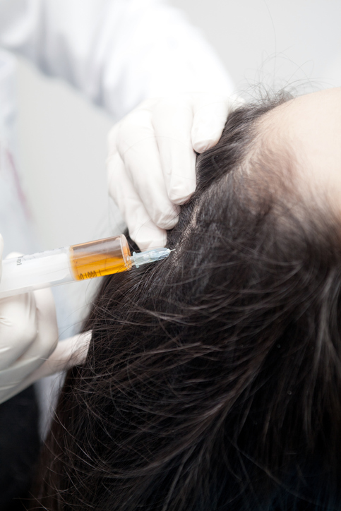 Hair Regrowth Therapy Australia |The Cosmetic Lounge