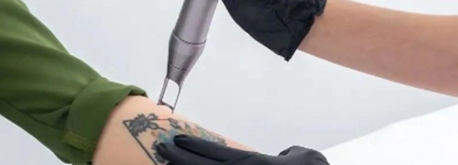 Winter Park Tattoo Removal Cover Image