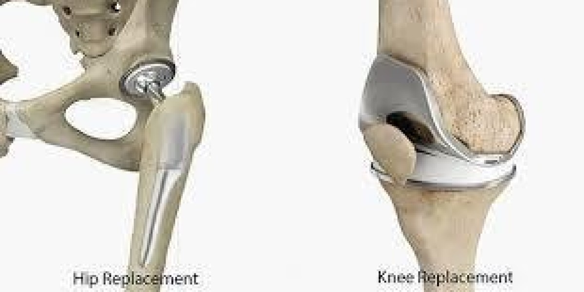 How Dr. Shohab Hyder Ensures Optimal Results in Hip and Knee Surgery in Karachi