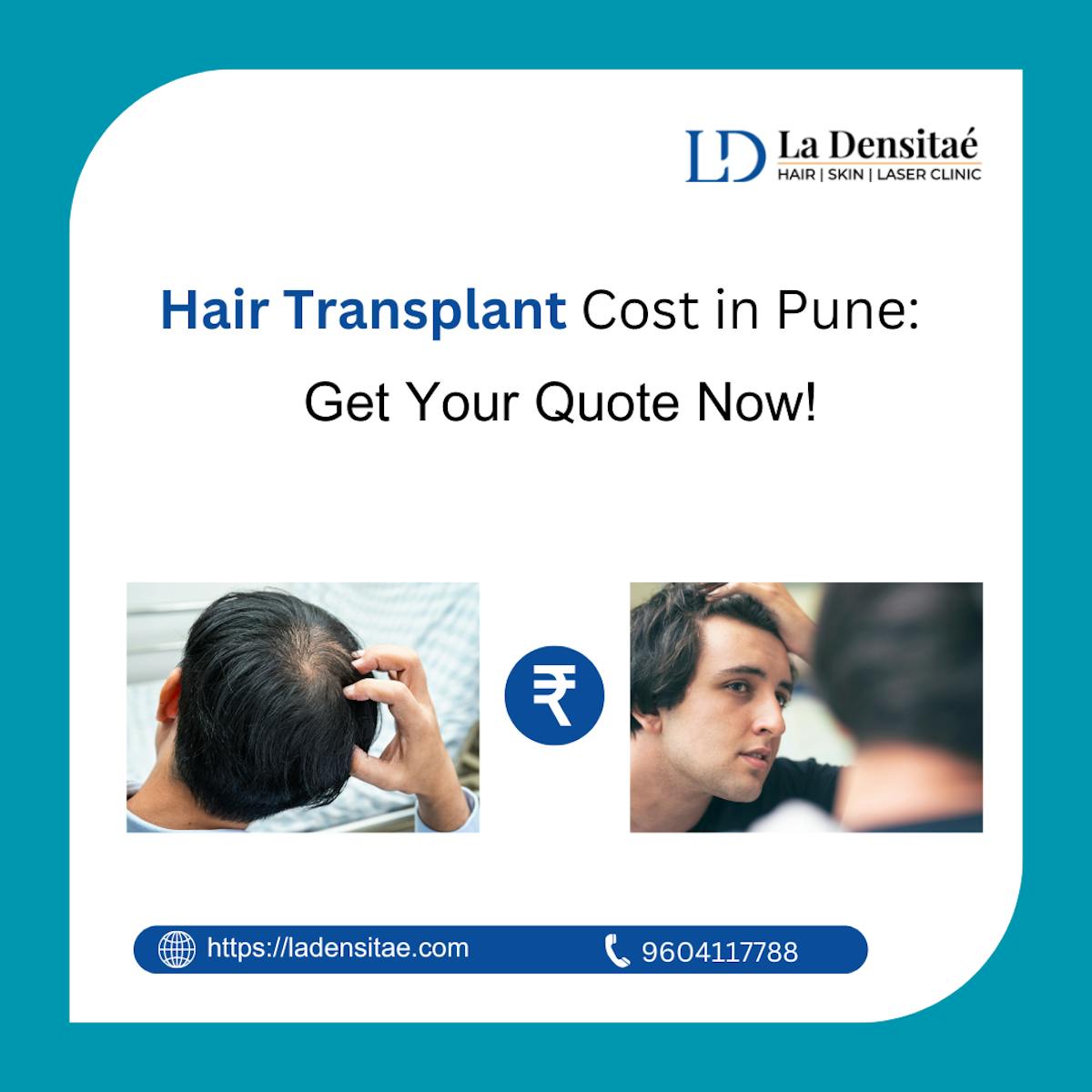 Understanding Hair Transplant Cost in Pune: A Simple Guide