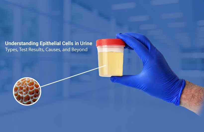 Epithelial Cells in Urine: Types, Causes & Test Insights