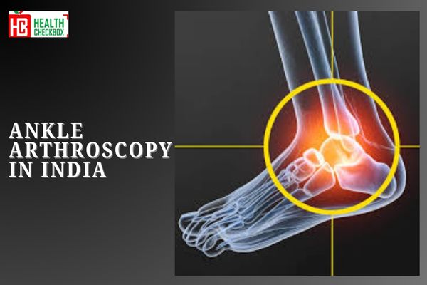 ANKLE ARTHROSCOPY - SURGERY IN INDIA