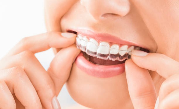 Is Cosmetic Dentistry Right for You?