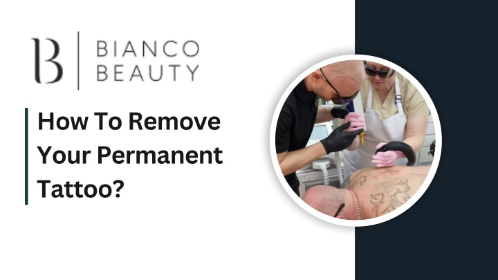 How To Remove Your Permanent Tattoo?