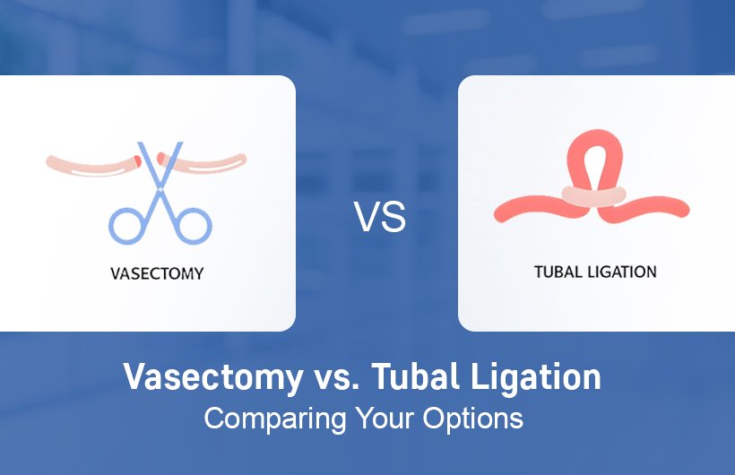 Vasectomy vs Tubal Ligation: Which is Right for You