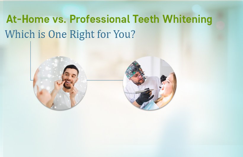 At-Home vs. Professional Teeth Whitening: Which Is Best?