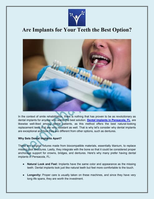 Are Implants for Your Teeth the Best Option | PDF