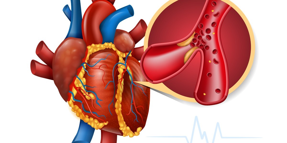 The Myocardial Infarction Market is driven by rising cardiovascular diseases