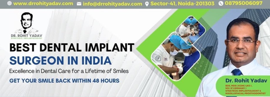 Dental Implant Specialist in India Dr Rohit Yadav Cover Image