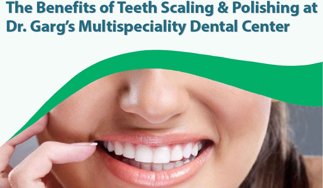 Say Goodbye to Plaque: The Benefits of Teeth Scaling and Polishing at Dr. Garg’s Multispeciality Dental Center