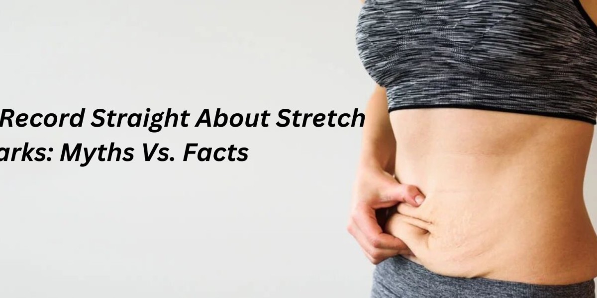 Setting The Record Straight About Stretch Marks: Myths Vs. Facts